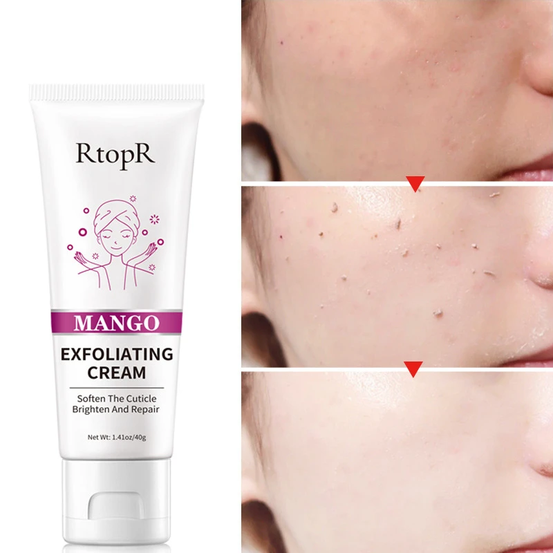 

Face Exfoliating Cream Deep Exfoliator Gel Moisturizer Mango Repair Facial Scrub Cleaner Whiteing Brighten Face Skin Care