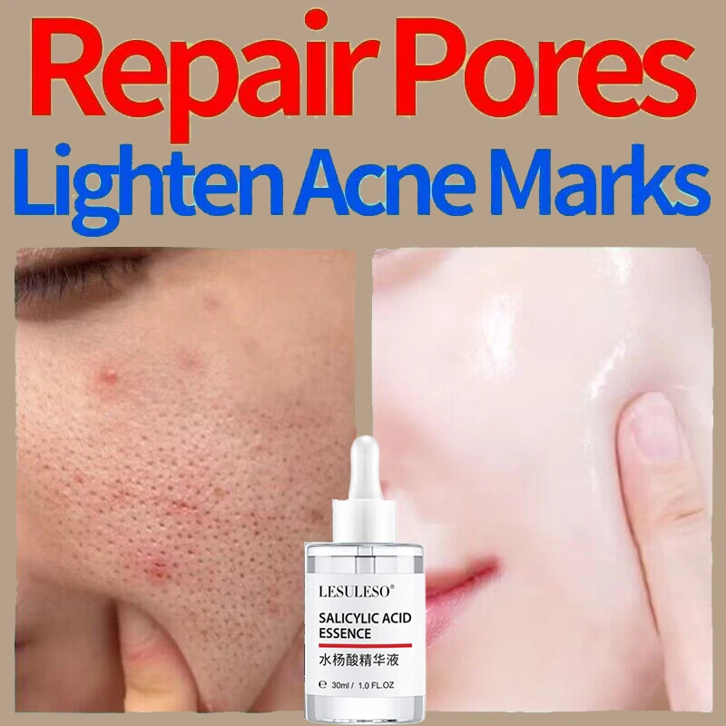 

Salicylic Acid Pore Shrink Face Serum Fade Acne Spots Whitening Moisturizing Smooth Pores Repair Essence Korean SkinCare Product