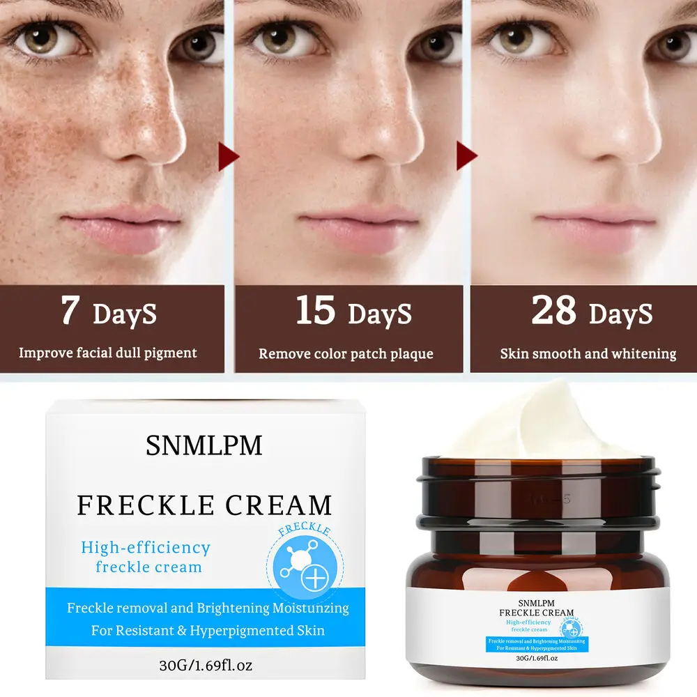 

30g Whitening Freckle Cream Remove Melasma Pigment Melanin Acne Spot Dark Spots Removal Skin Whitening Face Cream Skin Care