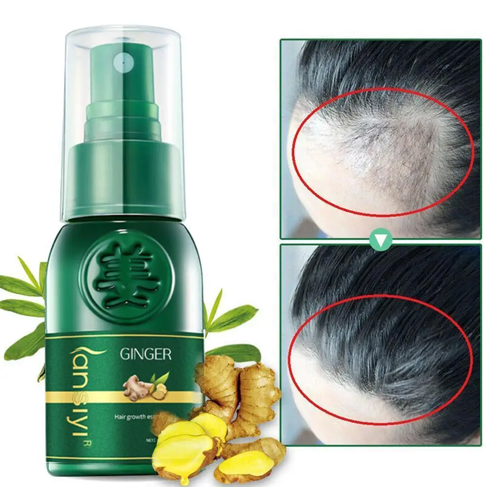 Three Scouts 30ml Hair Growth Spray Ginger Extract Essence Spray Products Effective Anti Hair Lose Nourish Treatments enhance Ha