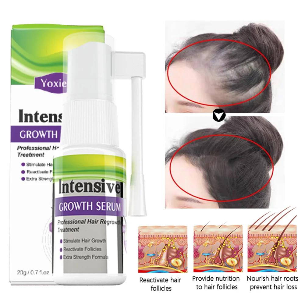 

Intensive Growth Serum Spray Promote Hair Regrowth Repair Damaged Prevent Baldness Treatment Germinal Liquid Ginger Scalp Care