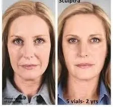 

Средство для регенерации коллагена для лица Sculpt r Pl la Crea m