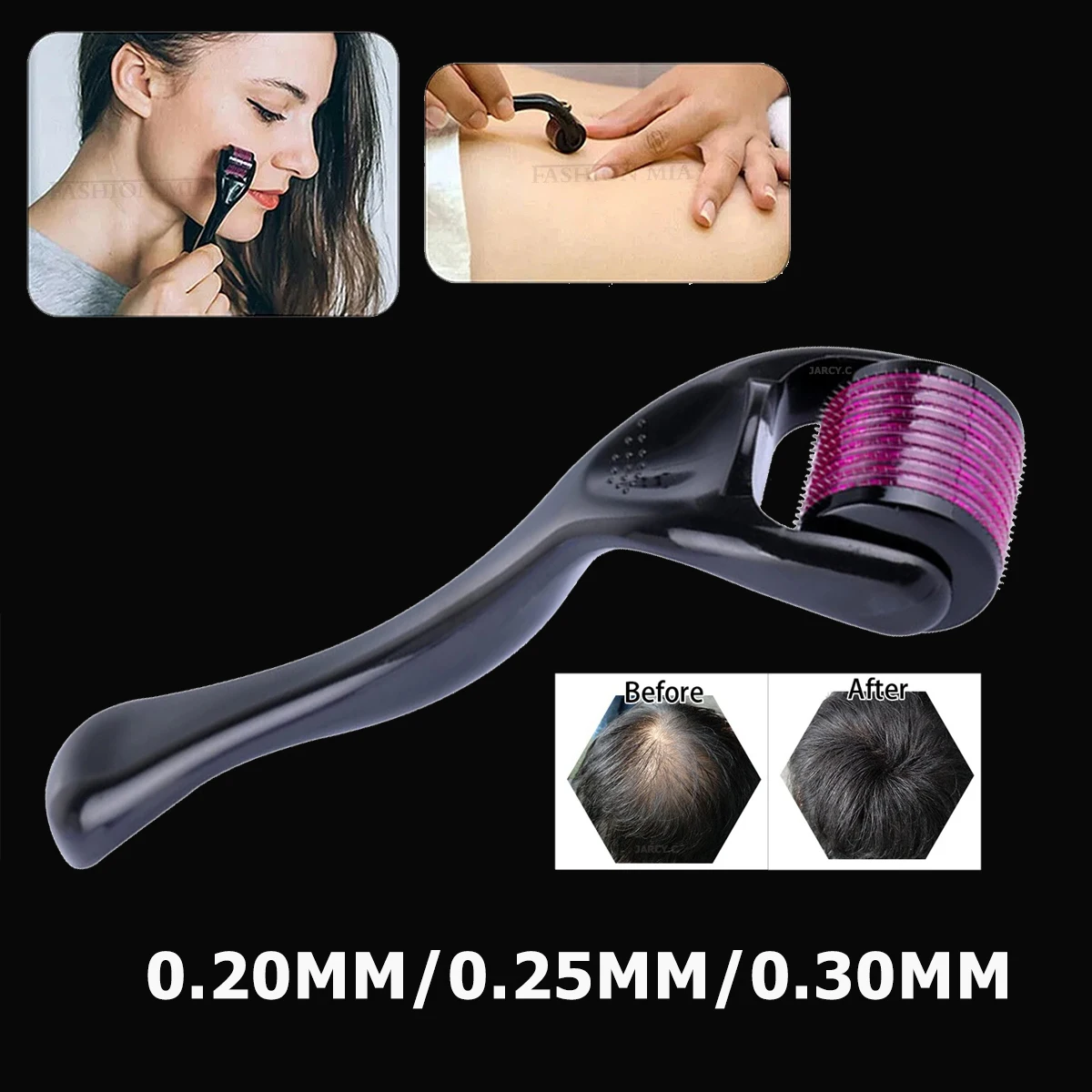 

Drs 540 Derma Roller Micro Needles Titanium Mezoroller Microneedle for Hair Growth Beauty Facial Skin Care Mesotherapy Treatment