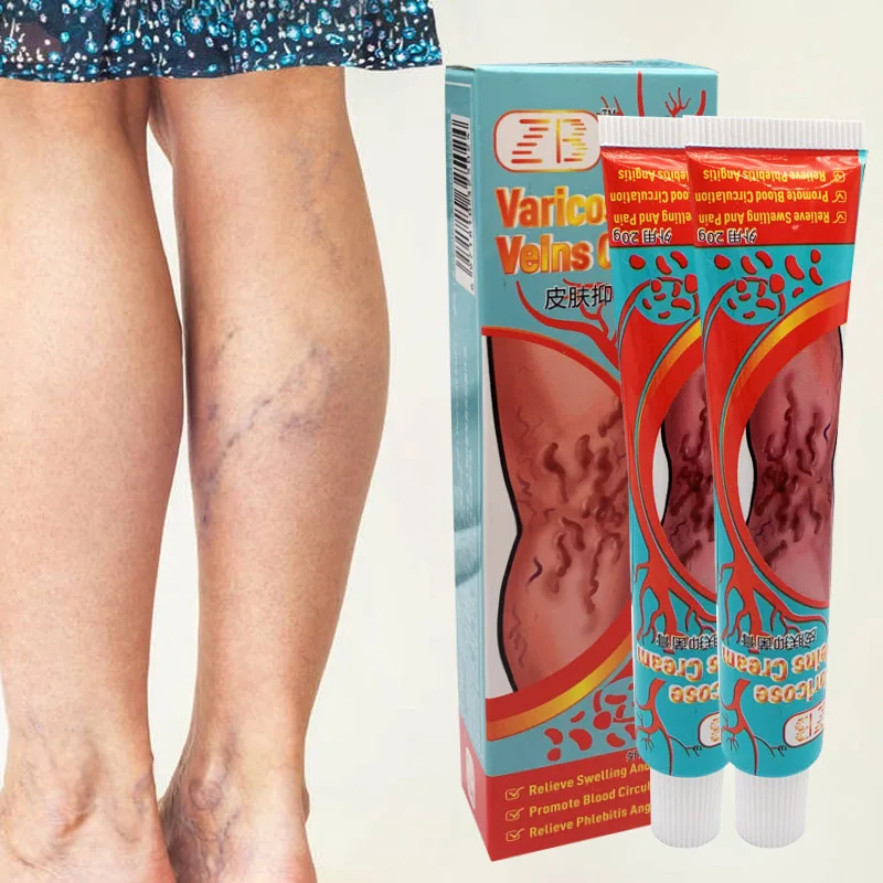 

10PCS Varicose Veins Treatment Cream 100% Original Vasculitis Phlebitis Spider Pain Relief Ointment Medical Plaster 20g