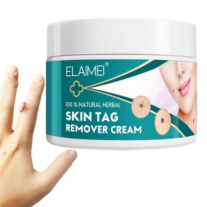 

Skin Tags Remover Cream Mole Dark Spot Flat Warts Corns Remover Ointment Facial Wart Tags Treatments Removal Cream Skin Care