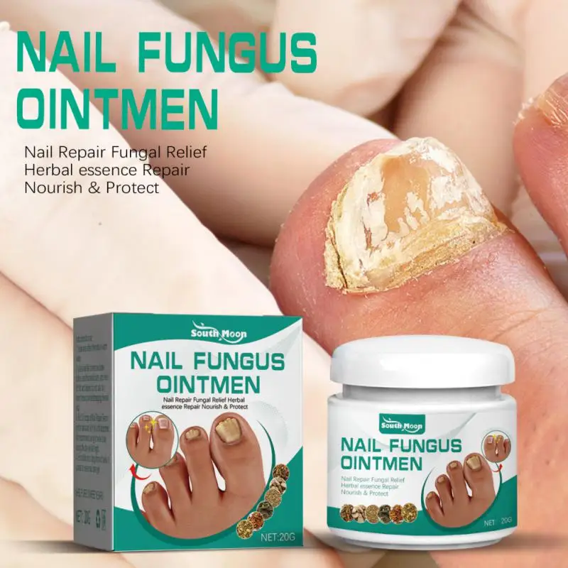 

20g Grey Nail Repairing Cream Fungus Treatments Balm Nourish And Protect Ointmen Soften Hand And Foot Nails Manicure Care