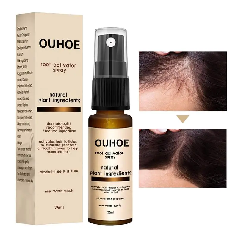 

Hair Growth Spray Hair Regeneration Spray For Men Hair Volumizing Spray Hair Regrowth Spray Thickening 25ml Promotes Regrowth