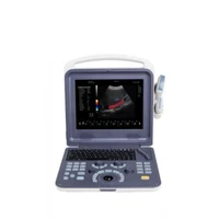 portable 4d cardiac color doppler ultrasound scanner machine