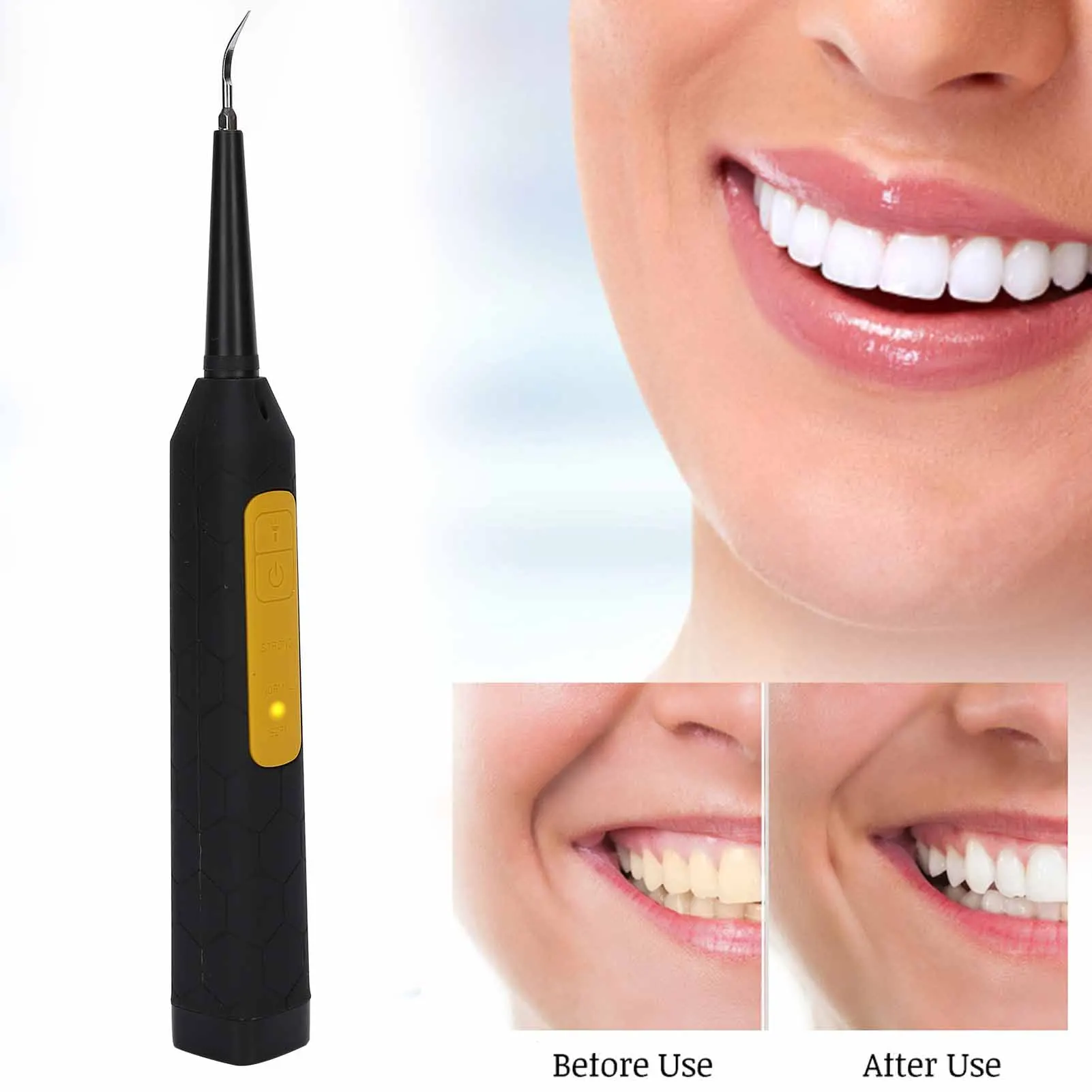 Электрический стоматологический скалер зубной очиститель с головкой из