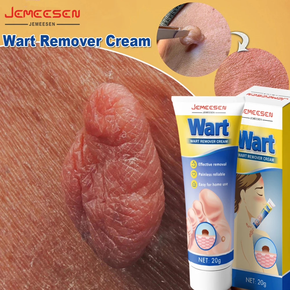 

Clear Body Tag Serum Cream Painless Removal of Common Wart Papilloma Treatment Skin Tissue Hyperplasia Dark Spot Removal Cream