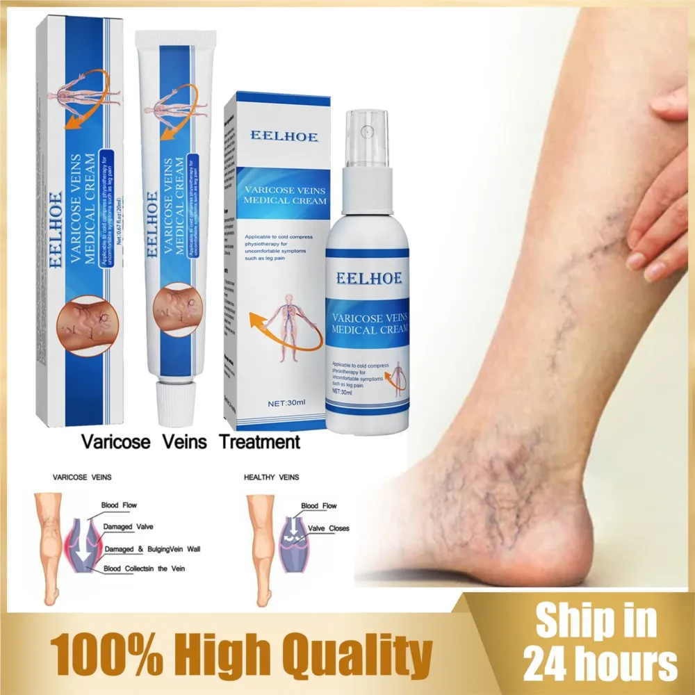 

Varicose Veins Spray Massage Varicose Relieves Veins Earthworm Legs Spray Relieve Leg Pain Blood Vessel Bulging Cream Treatment