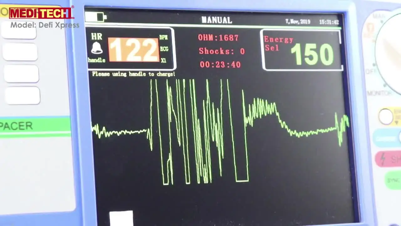 

Китайский завод, обновленный профессиональный производитель, монитор дефибриллятора