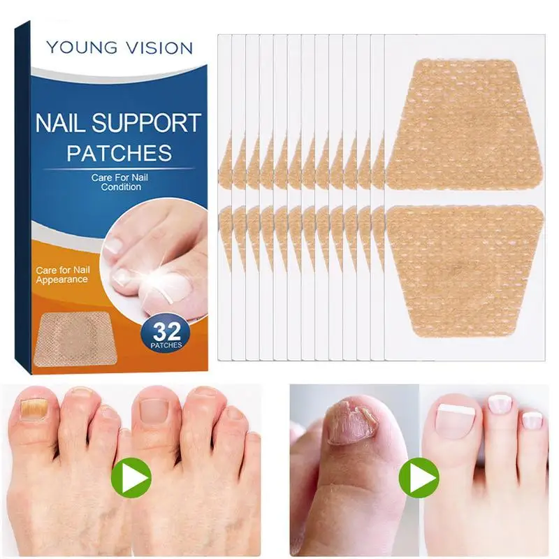 

Nail Repair Patches 32 PCS Cracked Toenail Repair Nail Patch Toenail Repair Nail Patch Convenient Non-woven Nail Repair Renewal