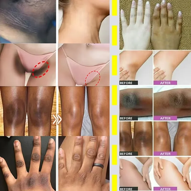 Отбеливающее мыло для тела