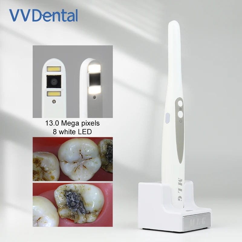 Фото Беспроводная стоматологическая камера VV Dendal MLG CF-680 (2-е поколение): портативная система стоматологической визуализации с интеллектуальным фокусом, 13,0 Мп, FS №5