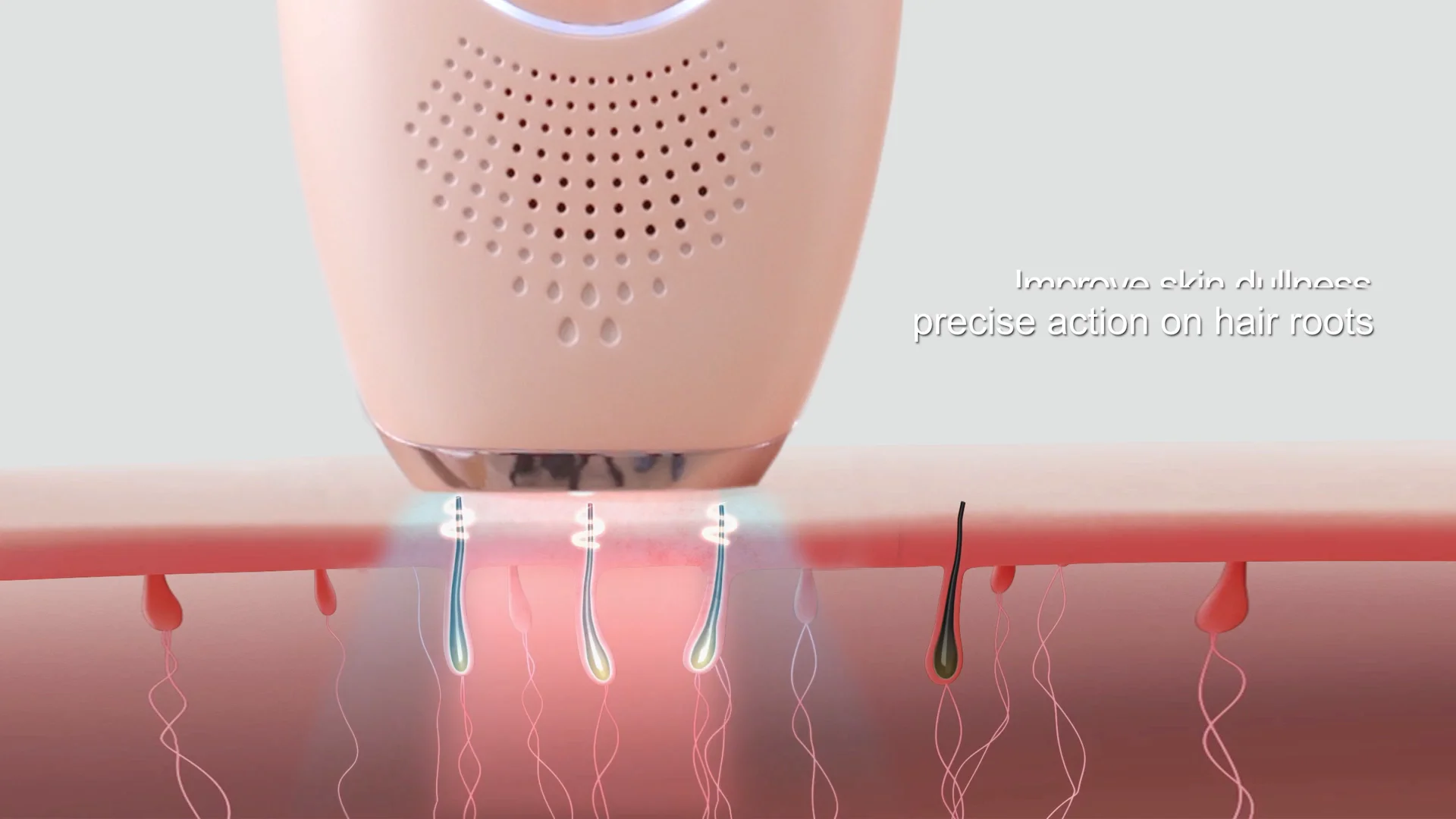 

Best Selling Legs Womens Electric Hair Removal Rechargeable IPL ICE Hair Electric Epilator