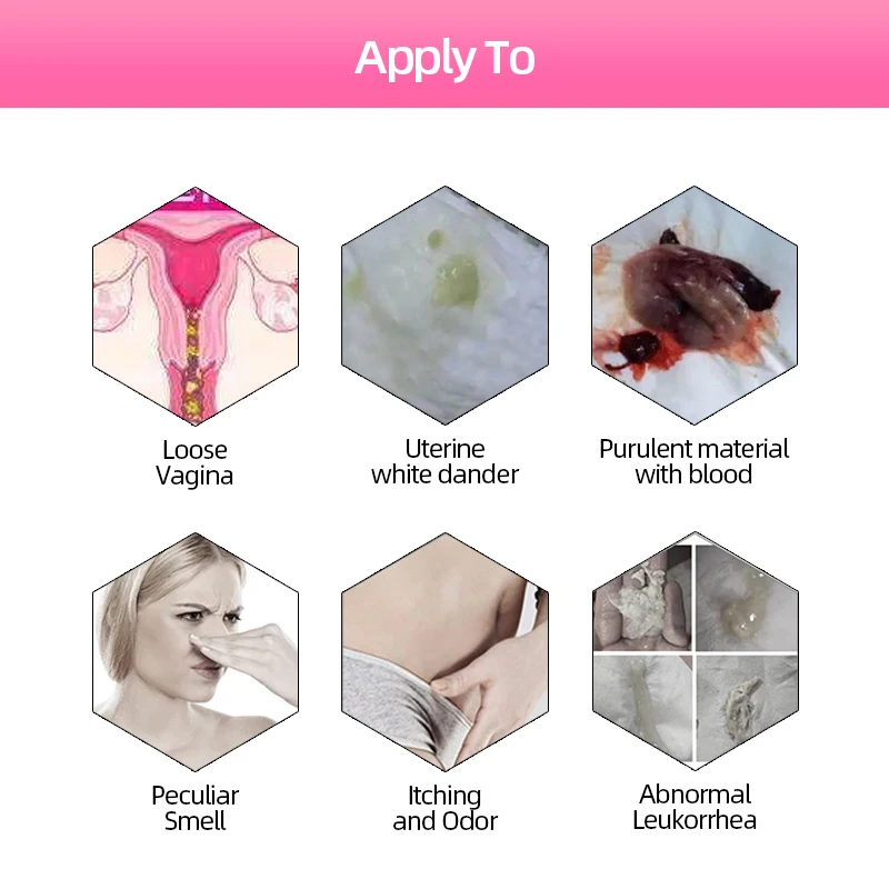 Laysan Utyasheva yalangoch