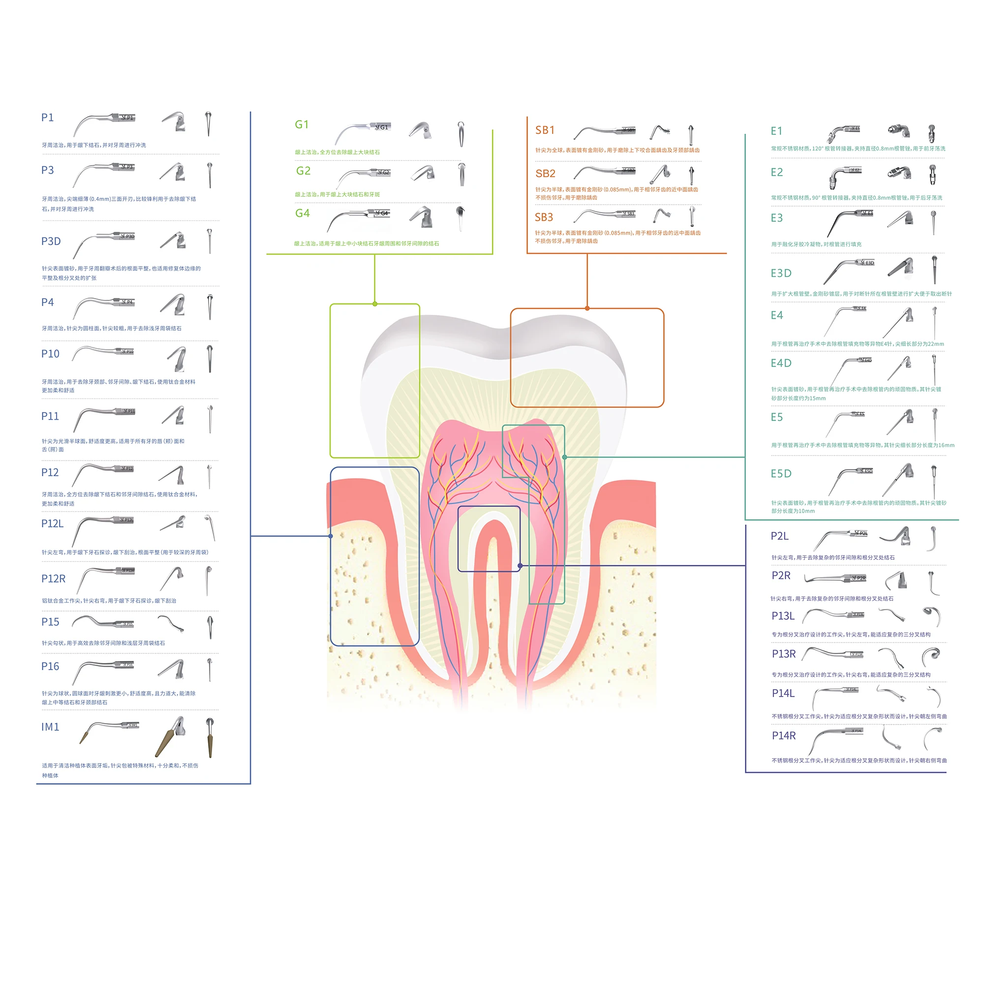 P2L Кончик иглы изогнут влево для удаления камней в сложных соседних щелях и
