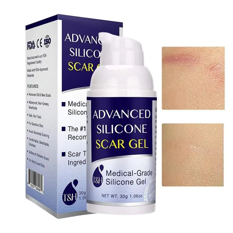 

Силиконовый гель для шрамов, улучшенный силиконовый гель для шрамов с-образным сечением и растяжением, средство для удаления старых и новых шрамов, необходимое для беременных