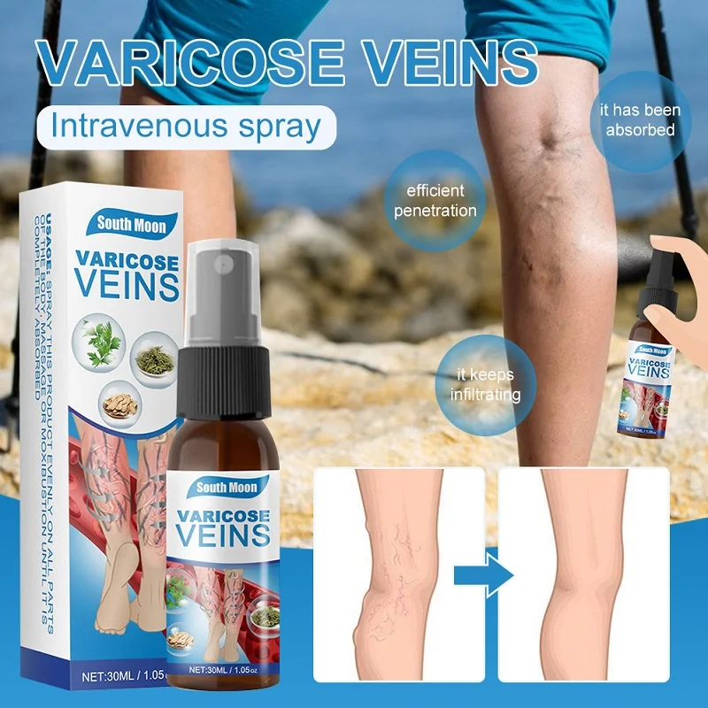 

Varicose Vein Relief Spray Relief Phlebitis Vasculitis Leg Swelling Pain Blood Vessel Bulge Venous Edema Intravenous Spray 30ml