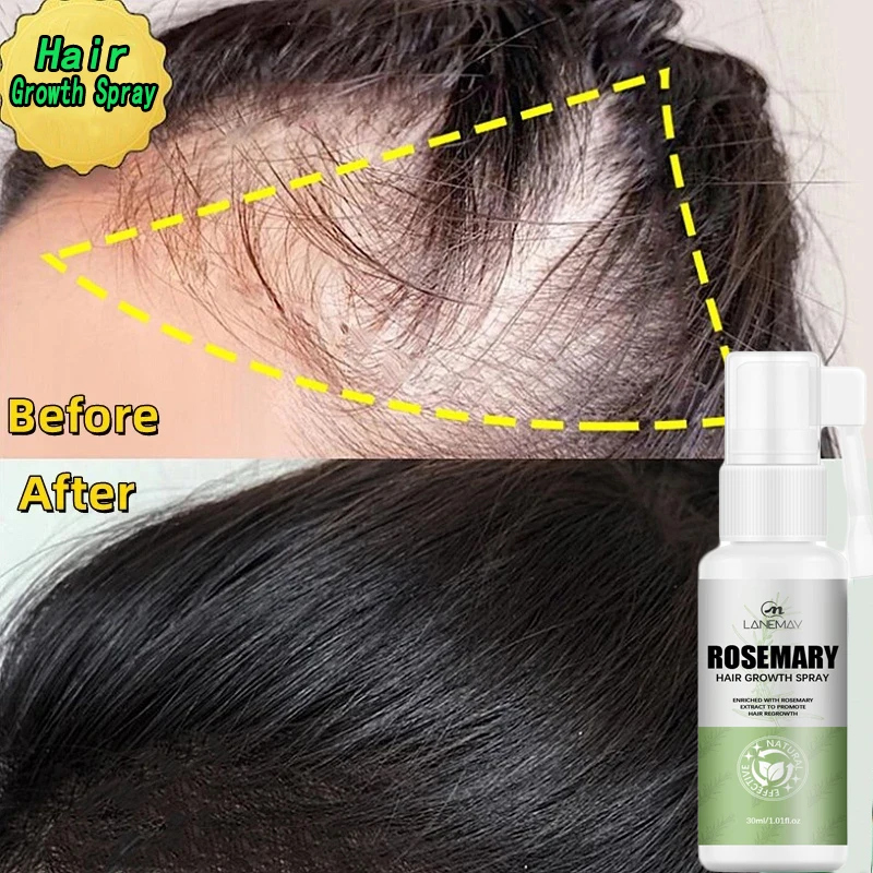 

Fast Hair Growth Serum Spray 100% African Crazy Traction Alopecia Anti Hair Loss Essential Prevents Bald Thinnin Hair Care Oil