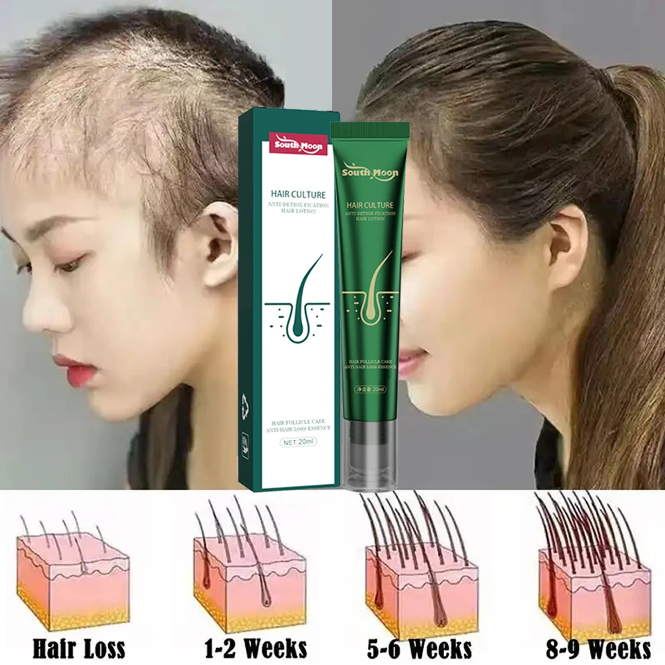 2023 Biotin Fast Hair Growth Oil Anti-Hair Loss Hair Thinning Treatment Regrowth Serum for Women amp Men Beard Hair Care Product