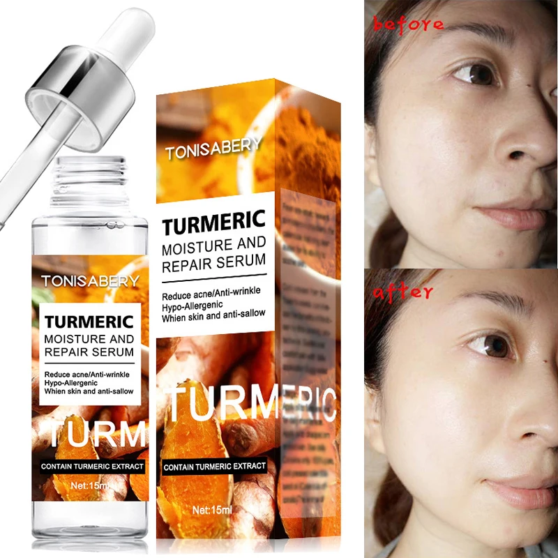 

Turmeric Whitening Freckle Removal Face Serum Lighten Dark Spots Melanin Chloasma Improve Dullness Anti-aging Wrinkle Skin Care