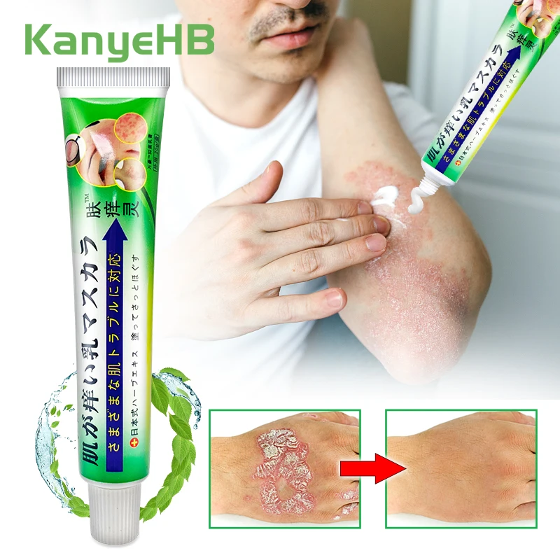 

1pcs Eczema Dermatitis Allergy Rash Skin Pruritus Psoriasis Treatment Cream Beriberi Mint Cooling Cream Family Necessities S111