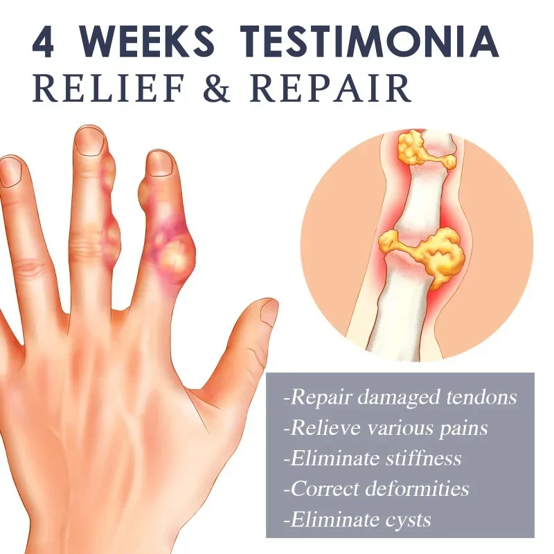 Мазь с пчелиным ядом для снятия боли в коленях плечах шее и поясницах