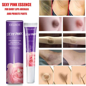 Body Whitening Cream For Dark Skin Intimate Area Pink Essence Dullness Brighten Skin Whitener Beauty Health For Dropshipping 20g 4