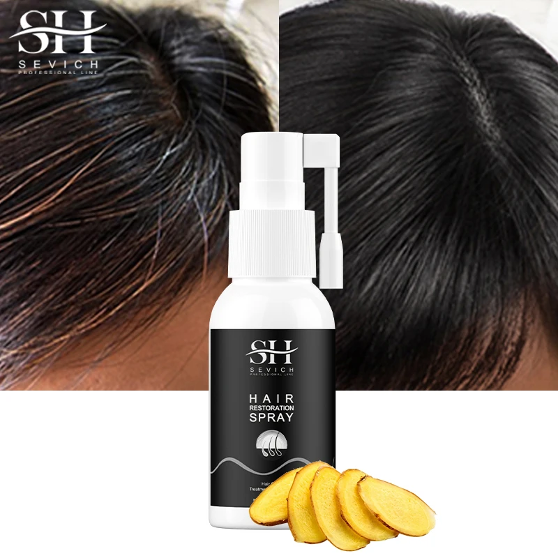 

Sevich 30ml Ginger Natural Black Hair Spray Anti-hair Loss Treatment Black Hair Color Dye Hair Growth Product Hair Care Hot