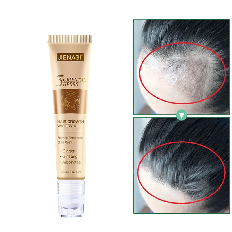 

Ginseng Hair Fast Regrowth Growth Roller Serum Pousse De Cheveux Keratina Oleo Para Crescimento Do Cabelo Orgânico Frete Gratis