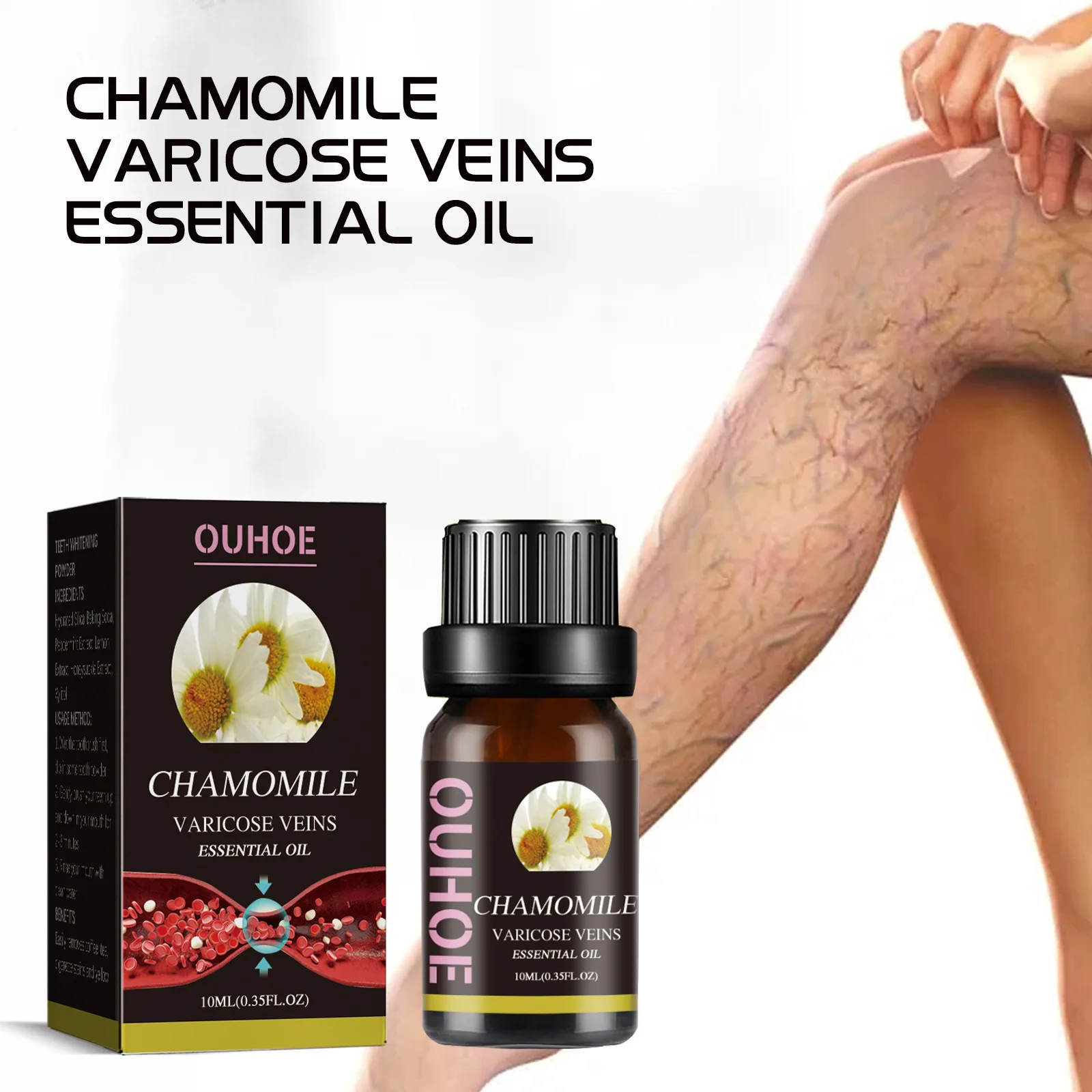 

Chamomile Varicose Veins Essential Oil Remove Spider Varicose Veins Improve Blood Circulation Capillary Reduce Venous Congestion