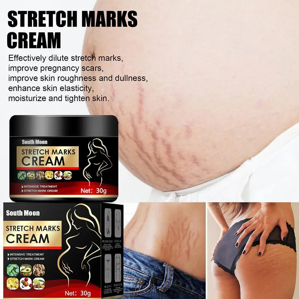 

Stretch Marks Removal Cream Maternity Scar Removal Cream Buttocks Breast Obesity Pregnancy Whitening Skin Repair