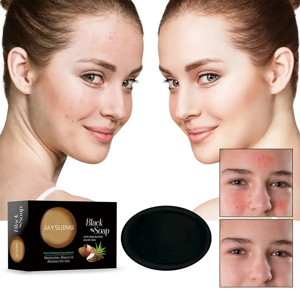 

Black Soap African Shea Butter Moisturizing Acne Cleanser For Smooth Face Anti Wrinkles Reduce Dark Spots Body Soap Bar X4N9