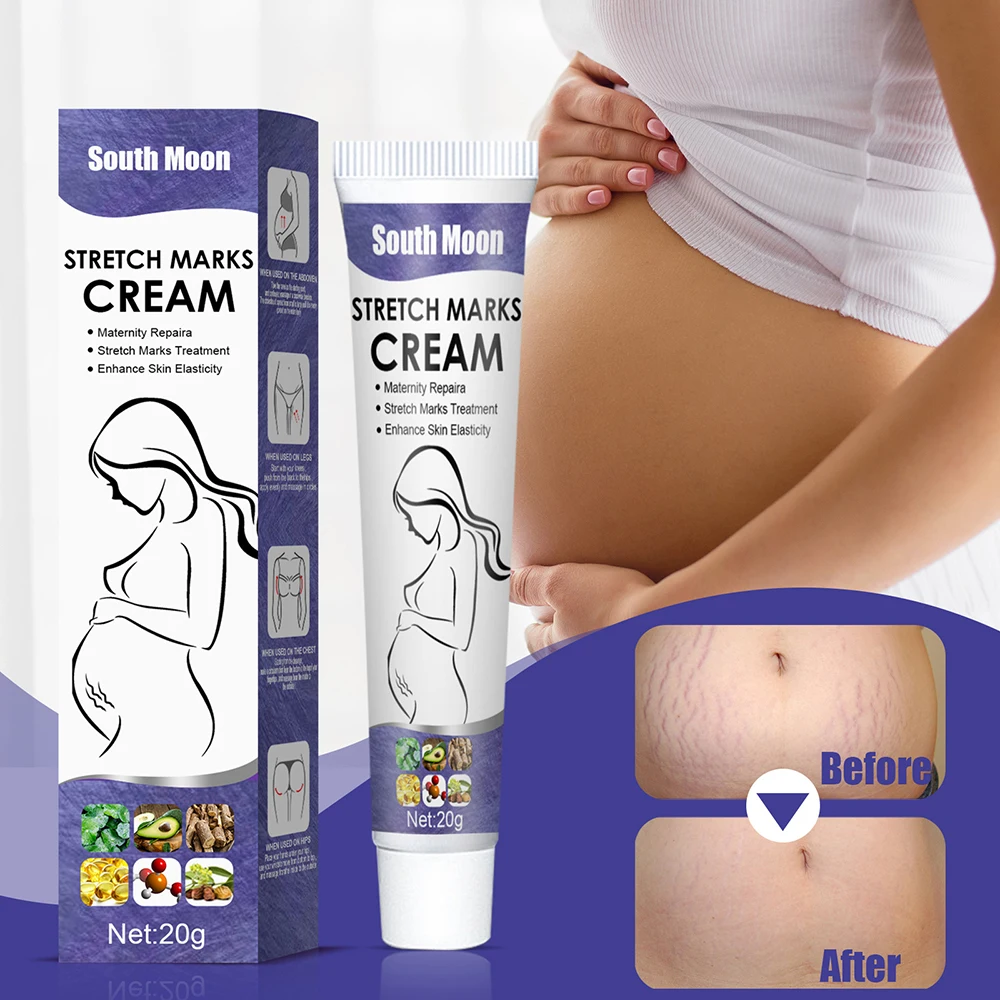 

Stretch marks cream Maternity Scars Acne Cream Pregnancy Remove Cream ESSENTI Skin Care Repair Anti-White Stretch 20g