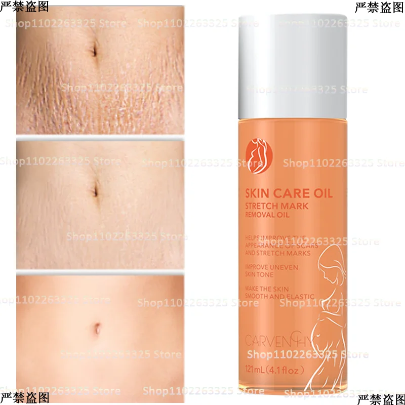 

Послеродовое укрепляющее восстанавливающее жидкость для массажа, опреснения, роста, ожирения, восстановление растений, растяжки, эфирное м...