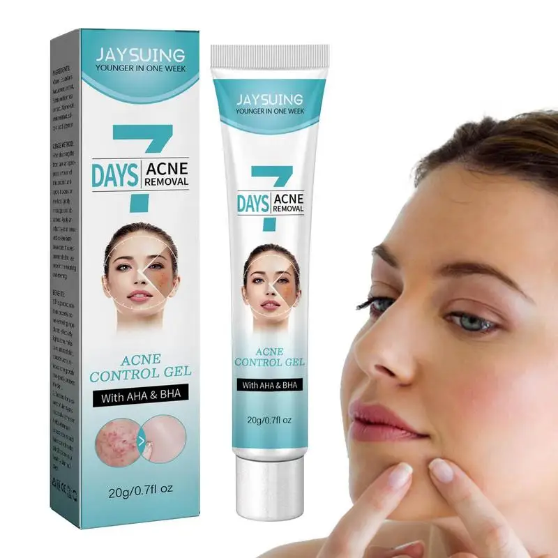 

7 Days Acne Remover Cream Lighten Dark Spots Pimples Marks Moisturizing Anti-inflammatory Remove Blackhead Whitening Face Gel