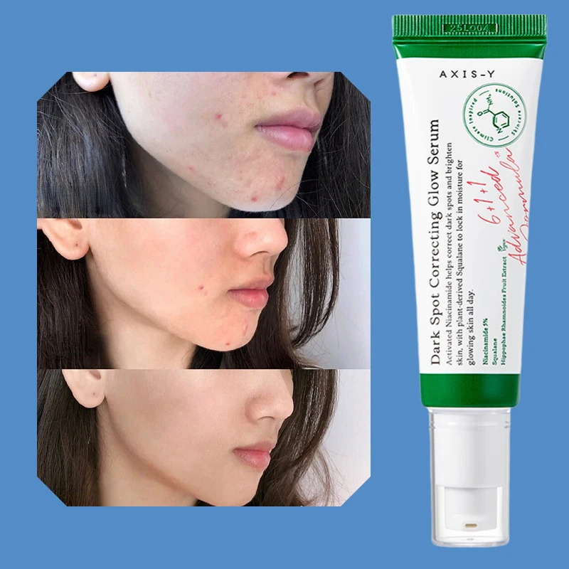 

Korea Axis-Y Dark Spot Correcting Glow Serum 50ml Authentic Improves Dull Skin Face Brightening Serum Lightens Soothes Skincare