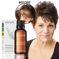 rosemary hair growth oil essence brown bottle nourishes strengthens hair dcalp massage treatment stimulates hair follicles serum