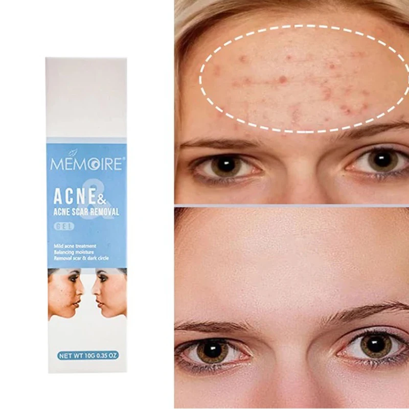 

Средство для удаления прыщей и шрамов от угрей