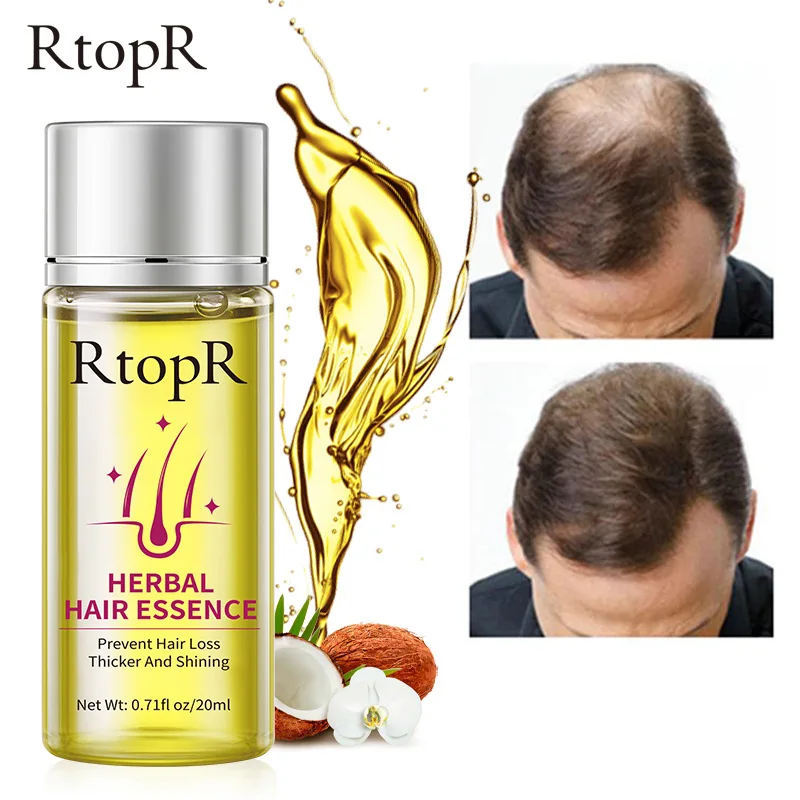 

Hair Growth Essential Oil Serum Ginger Anti Hair Loss Treatment Products Dry Frizzy Damaged Thin Hair Nourish Spray Health Care