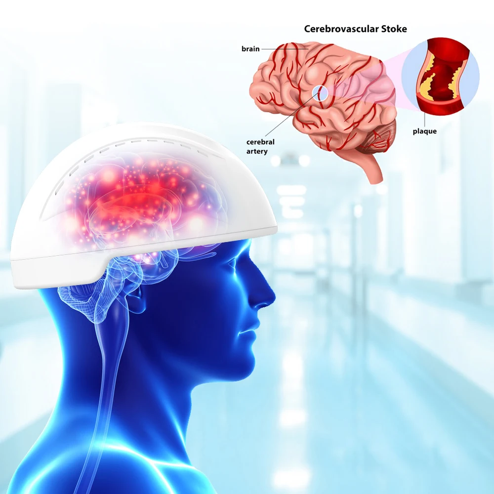 

Therapy device PBM hemet for brain injury rehabilitation 810nm Transcranial Magnetic Stimulation depression treatment equipment