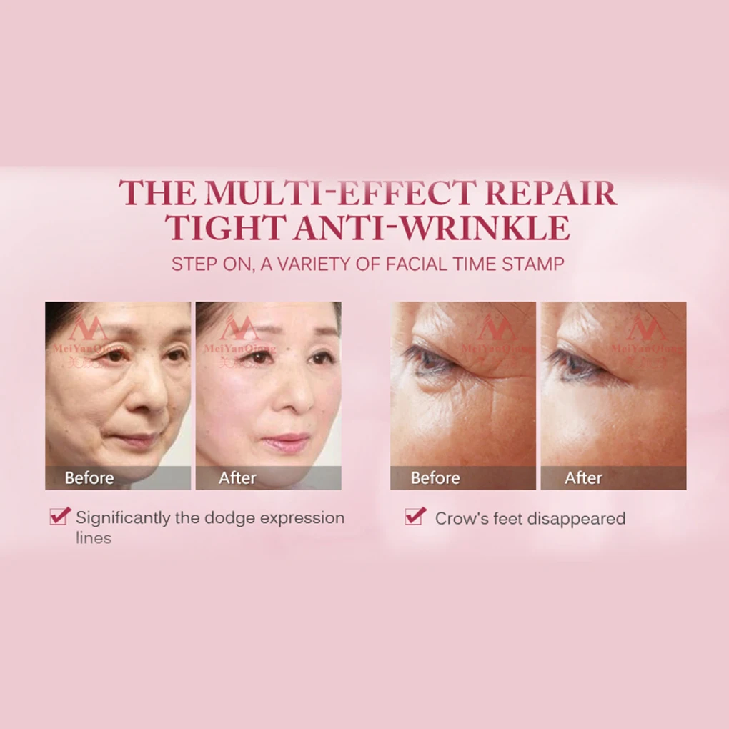 

Argireline Six Peptides Repair Concentrate Rejuvenation Anti-aging Essence Anti Wrinkle Face Serum 12ml