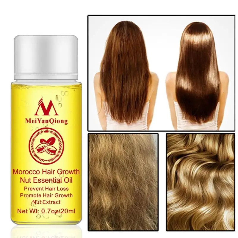 

Hair Ginger Growth Essential Oil Stimulate Follicles Effectively Strong Nourish Scalp Promote Growth Nourish Root Hair Care