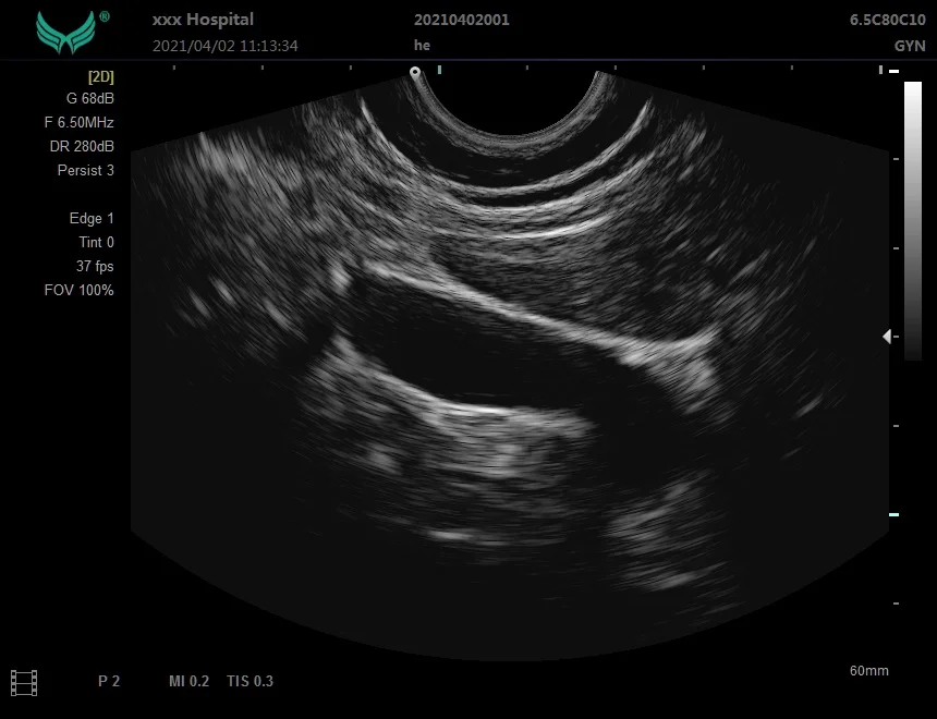 Ноутбук YD-P20 B/W ультразвуковая диагностическая система портативная цена