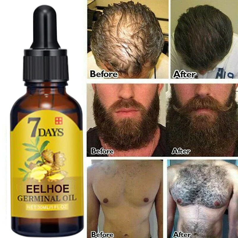 

10ml/20ml/40ml Ginger Hair Growth Serum Liquid Natural Efective Treat Bald Thinning Hair Regrowth Oil Men Women Thick Hair Care