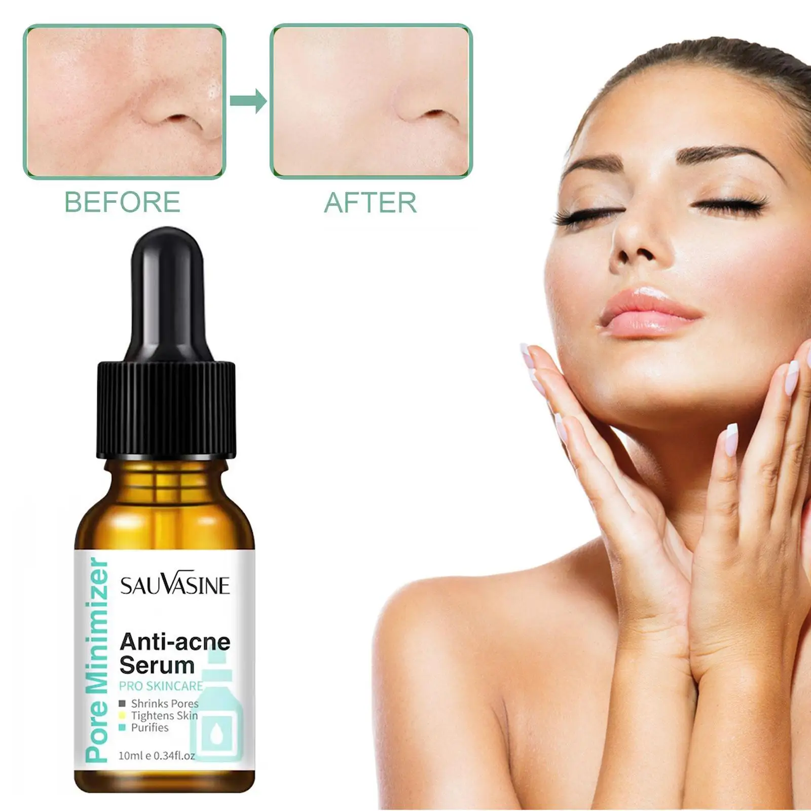 

Сыворотка для сужения пор, лечение акне, контроль жирности лица, увлажнение, уход за кожей, удаление черных точек, шрамы от акне, осветление, ...