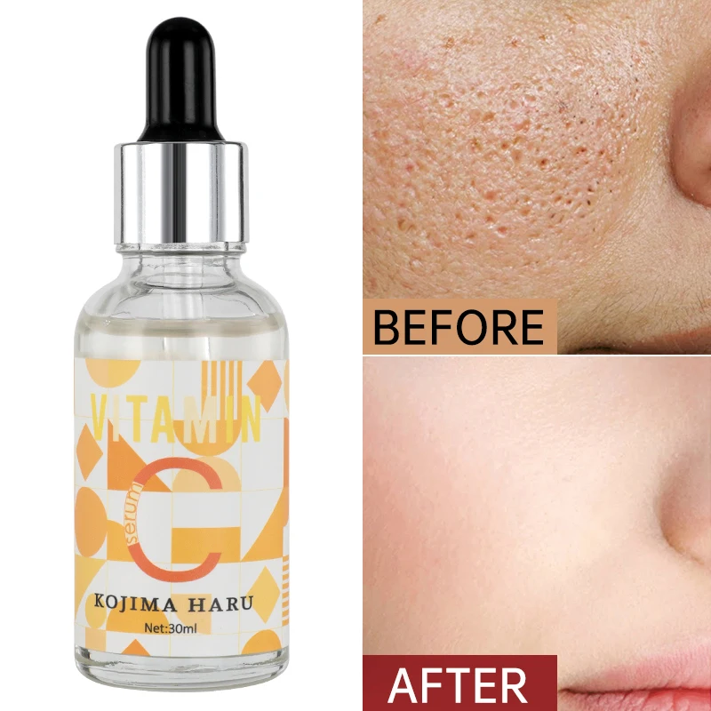 

Vitamin C Serum For Face Reduce The Look Of Aging Booster,Natural Organic Skin Care For Acne Scars,Wrinkles, Fades Dark,Age Spot