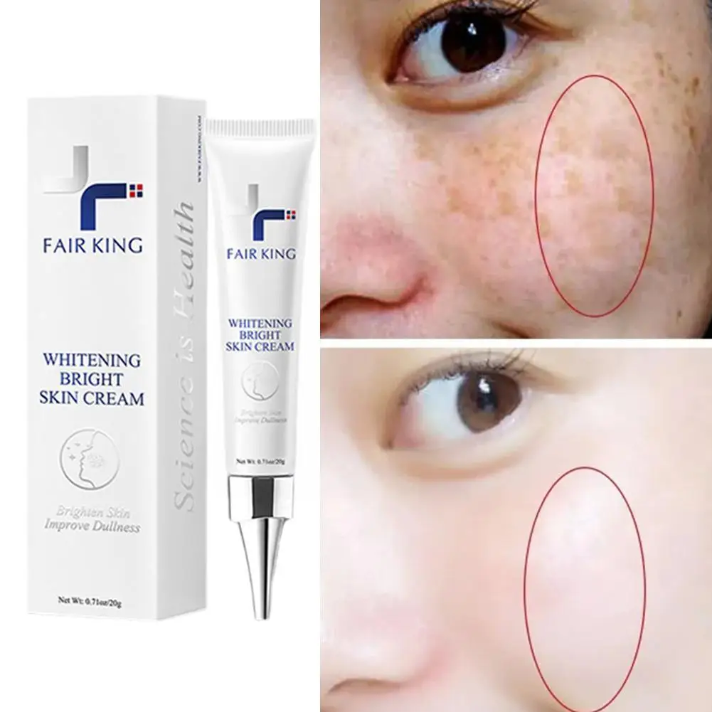 

20g Spot Cream Remove Chloasma Eliminate Dark Spots Care Tone Skin Skin Face Improves Brighten Skin Products Dull Care U4O1